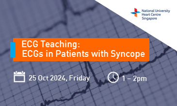 NUHCS: ECGs in Patients With Syncope